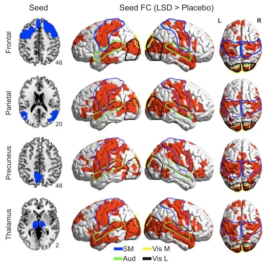 Increased Global Functional Connectivity Correlates with LSD Induced Ego Dissolution